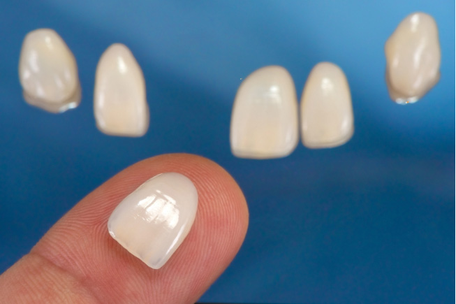 Jemand zeigt eine Reihe von Veneers, dabei hat er ein Veneer auf seiner Fingerkuppe liegen